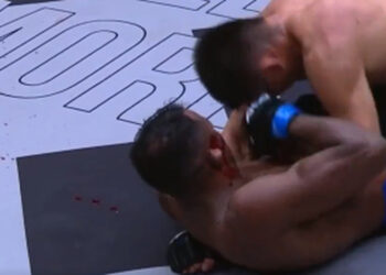 NSFW Video! Fight Stopped After Cauliflower Ear Explodes In Bloody Mess